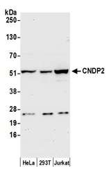CNDP2 Antibody - Detection of human CNDP2 by western blot. Samples: Whole cell lysate (50 µg) from HeLa, HEK293T, and Jurkat cells prepared using NETN lysis buffer. Antibody: Affinity purified rabbit anti-CNDP2 antibody used for WB at 0.1 µg/ml. Detection: Chemiluminescence with an exposure time of 30 seconds.