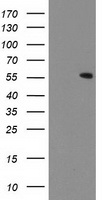 CNDP2 Antibody - HEK293T cells were transfected with the pCMV6-ENTRY control (Left lane) or pCMV6-ENTRY CNDP2 (Right lane) cDNA for 48 hrs and lysed. Equivalent amounts of cell lysates (5 ug per lane) were separated by SDS-PAGE and immunoblotted with anti-CNDP2.