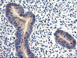 CNDP2 Antibody - IHC of paraffin-embedded Human endometrium tissue using anti-CNDP2 mouse monoclonal antibody.