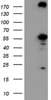 CNDP2 Antibody - HEK293T cells were transfected with the pCMV6-ENTRY control (Left lane) or pCMV6-ENTRY CNDP2 (Right lane) cDNA for 48 hrs and lysed. Equivalent amounts of cell lysates (5 ug per lane) were separated by SDS-PAGE and immunoblotted with anti-CNDP2.
