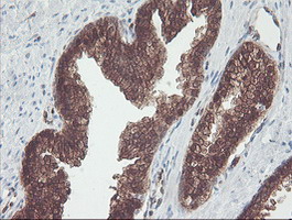 CNDP2 Antibody - IHC of paraffin-embedded Human prostate tissue using anti-CNDP2 mouse monoclonal antibody.