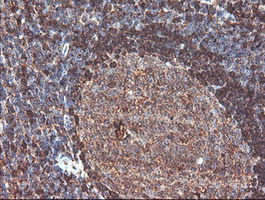CNDP2 Antibody - IHC of paraffin-embedded Human tonsil using anti-CNDP2 mouse monoclonal antibody.