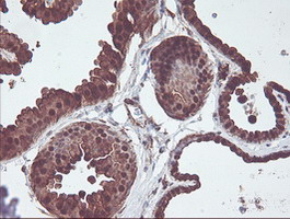CNDP2 Antibody - IHC of paraffin-embedded Human breast tissue using anti-CNDP2 mouse monoclonal antibody.