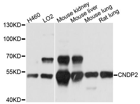 CNDP2 Antibody - Western blot analysis of extracts of various cell lines, using CNDP2 antibody at 1:1000 dilution. The secondary antibody used was an HRP Goat Anti-Rabbit IgG (H+L) at 1:10000 dilution. Lysates were loaded 25ug per lane and 3% nonfat dry milk in TBST was used for blocking. An ECL Kit was used for detection and the exposure time was 5s.