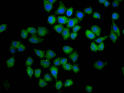 CNFN Antibody - Immunofluorescence staining of Hela cells diluted at 1:100, counter-stained with DAPI. The cells were fixed in 4% formaldehyde, permeabilized using 0.2% Triton X-100 and blocked in 10% normal Goat Serum. The cells were then incubated with the antibody overnight at 4°C.The Secondary antibody was Alexa Fluor 488-congugated AffiniPure Goat Anti-Rabbit IgG (H+L).