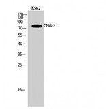 CNGA2 Antibody - Western blot of CNG-2 antibody