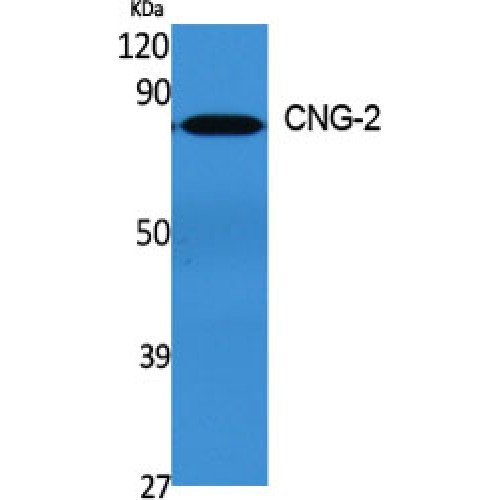 CNGA2 Antibody - Western blot of CNG-2 antibody