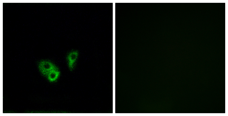 CNGA2 Antibody - Immunofluorescence analysis of A549 cells, using CNGA2 Antibody. The picture on the right is blocked with the synthesized peptide.