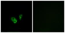 CNGA2 Antibody - Immunofluorescence analysis of A549 cells, using CNGA2 Antibody. The picture on the right is blocked with the synthesized peptide.