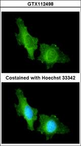 CNGA2 Antibody - Immunofluorescence of methanol-fixed HeLa using CNGA2 antibody at 1:200 dilution.