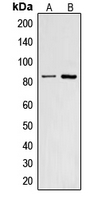 CNGA2 Antibody - Western blot analysis of CNGA2 expression in HepG2 (A); A431 (B) whole cell lysates.