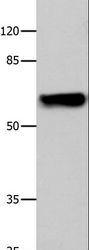 CNGA2 Antibody - Western blot analysis of 293T cell, using CNGA2 Polyclonal Antibody at dilution of 1:500.