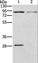 CNGA3 Antibody - Western blot analysis of Mouse kidney and brain tissue, using CNGA3 Polyclonal Antibody at dilution of 1:500.
