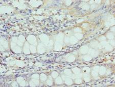 CNGA3 Antibody - Immunohistochemistry of paraffin-embedded Human rectal tissue at dilution 1:100