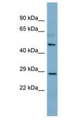 CNGA4 Antibody - CNGA4 antibody Western Blot of Fetal Thymus. Antibody dilution: 1 ug/ml.  This image was taken for the unconjugated form of this product. Other forms have not been tested.