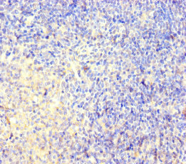 CNGA4 Antibody - Immunohistochemistry of paraffin-embedded human pancreatic tissue using CNGA4 Antibody at dilution of 1:100