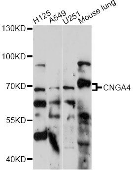 CNGA4 Antibody - Western blot analysis of extracts of various cell lines, using CNGA4 antibody at 1:1000 dilution. The secondary antibody used was an HRP Goat Anti-Rabbit IgG (H+L) at 1:10000 dilution. Lysates were loaded 25ug per lane and 3% nonfat dry milk in TBST was used for blocking. An ECL Kit was used for detection and the exposure time was 90s.