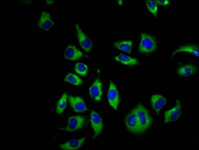 CNGB1 Antibody - Immunofluorescence staining of A549 cells diluted at 1:66, counter-stained with DAPI. The cells were fixed in 4% formaldehyde, permeabilized using 0.2% Triton X-100 and blocked in 10% normal Goat Serum. The cells were then incubated with the antibody overnight at 4°C.The Secondary antibody was Alexa Fluor 488-congugated AffiniPure Goat Anti-Rabbit IgG (H+L).