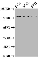 CNGB1 Antibody - Western Blot Positive WB detected in: Hela whole cell lysate, A549 whole cell lysate, 293T whole cell lysate All Lanes: CNGB1 antibody at 4.6µg/ml Secondary Goat polyclonal to rabbit IgG at 1/50000 dilution Predicted band size: 140, 71, 33 KDa Observed band size: 140 KDa