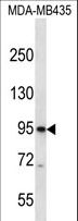 CNGB3 / CNG Channel Beta-3 Antibody - CNGB3 Antibody western blot of MDA-MB435 cell line lysates (35 ug/lane). The CNGB3 antibody detected the CNGB3 protein (arrow).