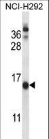 CNIH1 / CNIH Antibody - CNIH Antibody western blot of NCI-H292 cell line lysates (35 ug/lane). The CNIH antibody detected the CNIH protein (arrow).