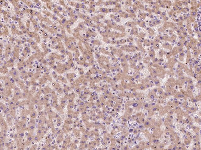 CNIH1 / CNIH Antibody - Immunochemical staining of human CNIH in human liver with rabbit polyclonal antibody at 1:100 dilution, formalin-fixed paraffin embedded sections.