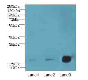 CNIH2 Antibody - Western blot. All lanes: CNIH2 antibody at 2 ug/ml. Lane 1: U251 whole cell lysate. Lane 2: Mouse liver tissue. Lane 3: Mouse kidney tissue. Secondary Goat polyclonal to Rabbit IgG at 1:10000 dilution. Predicted band size: 19 kDa. Observed band size: 19 kDa.
