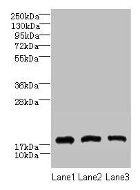 CNIH2 Antibody - Western blot All lanes: CNIH2 antibody at 2µg/ml Lane 1: U251 whole cell lysate Lane 2: Mouse liver tissue Lane 3: Mouse kidney tissue Secondary Goat polyclonal to rabbit IgG at 1/10000 dilution Predicted band size: 19 kDa Observed band size: 19 kDa