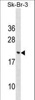 CNIH3 Antibody - CNIH3 Antibody western blot of SK-BR-3 cell line lysates (35 ug/lane). The CNIH3 antibody detected the CNIH3 protein (arrow).