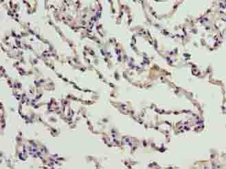 CNIH3 Antibody - Immunohistochemistry of paraffin-embedded human lung tissue using antibody at dilution of 1:100.