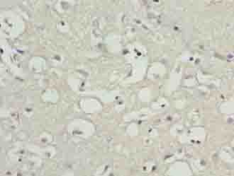 CNIH3 Antibody - Immunohistochemistry of paraffin-embedded human brain tissue using antibody at dilution of 1:100.
