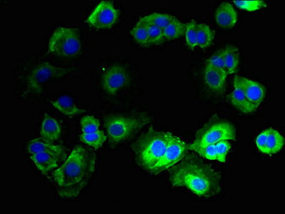 CNIH3 Antibody - Immunofluorescent analysis of MCF-7 cells using CNIH3 Antibody at dilution of 1:100 and Alexa Fluor 488-congugated AffiniPure Goat Anti-Rabbit IgG(H+L)