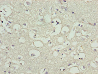 CNIH3 Antibody - Immunohistochemistry of paraffin-embedded human brain tissue using CNIH3 Antibody at dilution of 1:100