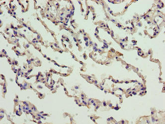 CNIH3 Antibody - Immunohistochemistry of paraffin-embedded human lung tissue using CNIH3 Antibody at dilution of 1:100