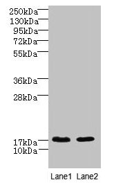 CNIH4 / HSPC163 Antibody - Western blot All lanes: CNIH4 antibody at 0.3µg/ml Lane 1: A431 whole cell lysate Lane 2: U251 whole cell lysate Secondary Goat polyclonal to rabbit IgG at 1/10000 dilution Predicted band size: 17, 11 kDa Observed band size: 17 kDa