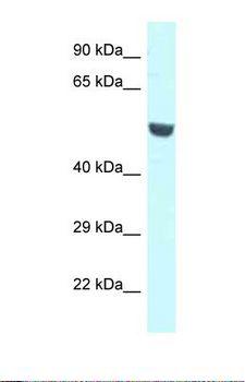CNKSR1 Antibody - Western blot of Human A549 . CNKSR1 antibody dilution 1.0 ug/ml.  This image was taken for the unconjugated form of this product. Other forms have not been tested.