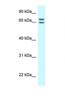 CNKSR1 Antibody - CNKSR1 antibody Western blot of 8226 Cell lysate. Antibody concentration 1 ug/ml.  This image was taken for the unconjugated form of this product. Other forms have not been tested.