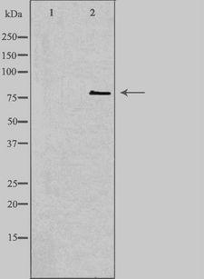 CNKSR1 Antibody - Western blot analysis of extracts of COLO cells using CNKR1 antibody. The lane on the left is treated with the antigen-specific peptide.