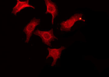 CNKSR1 Antibody - Staining COLO205 cells by IF/ICC. The samples were fixed with PFA and permeabilized in 0.1% Triton X-100, then blocked in 10% serum for 45 min at 25°C. The primary antibody was diluted at 1:200 and incubated with the sample for 1 hour at 37°C. An Alexa Fluor 594 conjugated goat anti-rabbit IgG (H+L) Ab, diluted at 1/600, was used as the secondary antibody.