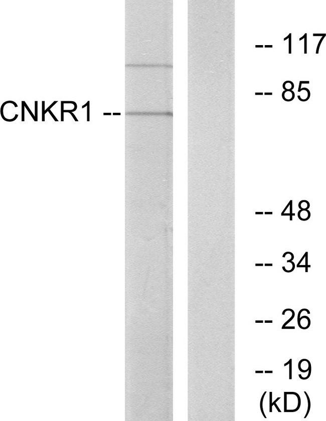 CNKSR1 Antibody - Western blot analysis of extracts from COLO cells, using CNKR1 antibody.