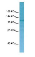CNKSR2 Antibody - CNKSR2 antibody Western Blot of 721_B.  This image was taken for the unconjugated form of this product. Other forms have not been tested.