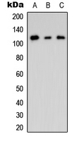 CNKSR2 Antibody - Western blot analysis of CNK2 expression in HEK293T (A); mouse Brain (B); rat brain (C) whole cell lysates.