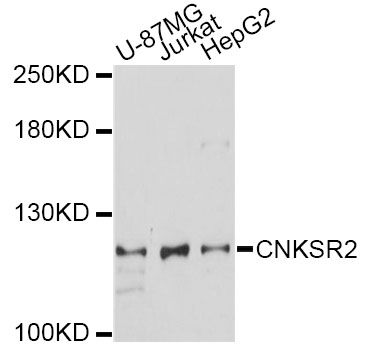 CNKSR2 Antibody - Western blot analysis of extracts of various cell lines, using CNKSR2 antibody at 1:1000 dilution. The secondary antibody used was an HRP Goat Anti-Rabbit IgG (H+L) at 1:10000 dilution. Lysates were loaded 25ug per lane and 3% nonfat dry milk in TBST was used for blocking. An ECL Kit was used for detection and the exposure time was 60s.