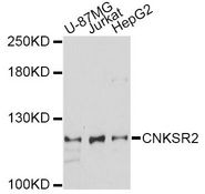 CNKSR2 Antibody - Western blot analysis of extracts of various cell lines, using CNKSR2 antibody at 1:1000 dilution. The secondary antibody used was an HRP Goat Anti-Rabbit IgG (H+L) at 1:10000 dilution. Lysates were loaded 25ug per lane and 3% nonfat dry milk in TBST was used for blocking. An ECL Kit was used for detection and the exposure time was 60s.