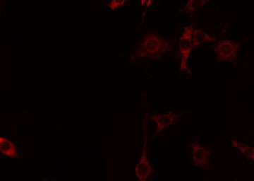 CNKSR2 Antibody - Staining HeLa cells by IF/ICC. The samples were fixed with PFA and permeabilized in 0.1% Triton X-100, then blocked in 10% serum for 45 min at 25°C. The primary antibody was diluted at 1:200 and incubated with the sample for 1 hour at 37°C. An Alexa Fluor 594 conjugated goat anti-rabbit IgG (H+L) Ab, diluted at 1/600, was used as the secondary antibody.