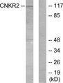 CNKSR2 Antibody - Western blot analysis of extracts from Jurkat cells, using CNKR2 antibody.