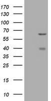 CNKSR3 Antibody - HEK293T cells were transfected with the pCMV6-ENTRY control (Left lane) or pCMV6-ENTRY CNKSR3 (Right lane) cDNA for 48 hrs and lysed. Equivalent amounts of cell lysates (5 ug per lane) were separated by SDS-PAGE and immunoblotted with anti-CNKSR3.