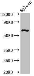 CNKSR3 Antibody - Western Blot Positive WB detected in: Mouse spleen tissue All lanes: CNKSR3 antibody at 2µg/ml Secondary Goat polyclonal to rabbit IgG at 1/50000 dilution Predicted band size: 62 kDa Observed band size: 62 kDa