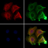 CNKSR3 Antibody - Staining HeLa cells by IF/ICC. The samples were fixed with PFA and permeabilized in 0.1% Triton X-100, then blocked in 10% serum for 45 min at 25°C. Samples were then incubated with primary Ab(1:200) and mouse anti-beta tubulin Ab(1:200) for 1 hour at 37°C. An AlexaFluor594 conjugated goat anti-rabbit IgG(H+L) Ab(1:200 Red) and an AlexaFluor488 conjugated goat anti-mouse IgG(H+L) Ab(1:600 Green) were used as the secondary antibod