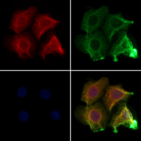 CNKSR3 Antibody - Staining HeLa cells by IF/ICC. The samples were fixed with PFA and permeabilized in 0.1% Triton X-100, then blocked in 10% serum for 45 min at 25°C. Samples were then incubated with primary Ab(1:200) and mouse anti-beta tubulin Ab(1:200) for 1 hour at 37°C. An AlexaFluor594 conjugated goat anti-rabbit IgG(H+L) Ab(1:200 Red) and an AlexaFluor488 conjugated goat anti-mouse IgG(H+L) Ab(1:600 Green) were used as the secondary antibod
